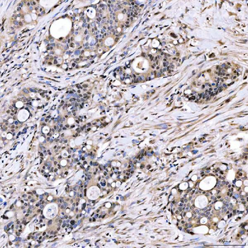 SMOX Rabbit Polyclonal Antibody