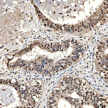 SMOX Rabbit Polyclonal Antibody