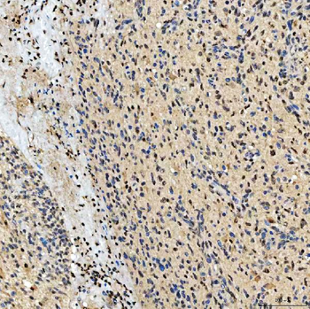 SMOX Rabbit Polyclonal Antibody
