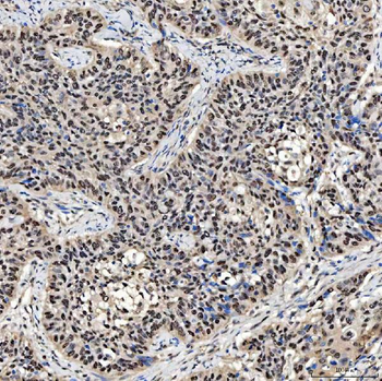 SMOX Rabbit Polyclonal Antibody