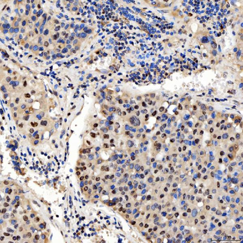 SMOX Rabbit Polyclonal Antibody
