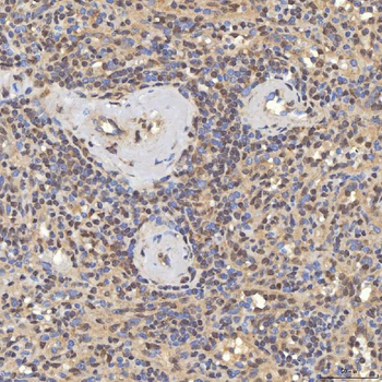 SNF2H/SMARCA5 Rabbit Polyclonal Antibody