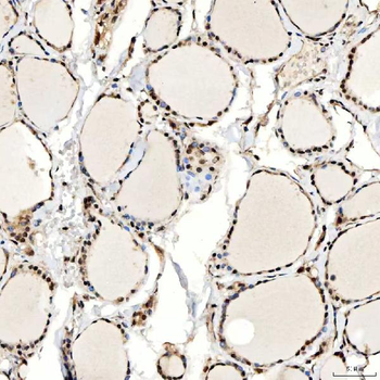 SNF2H/SMARCA5 Rabbit Polyclonal Antibody
