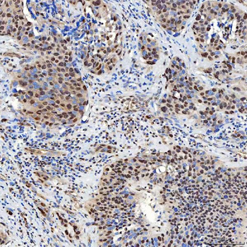 SNF2H/SMARCA5 Rabbit Polyclonal Antibody