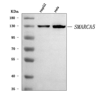 SNF2H/SMARCA5 Rabbit Polyclonal Antibody