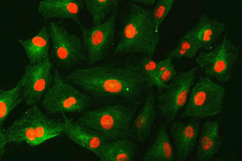 SNF2H/SMARCA5 Rabbit Polyclonal Antibody
