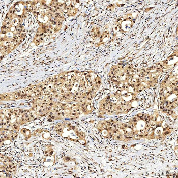 SNF2H/SMARCA5 Rabbit Polyclonal Antibody
