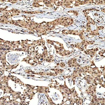 SNF2H/SMARCA5 Rabbit Polyclonal Antibody