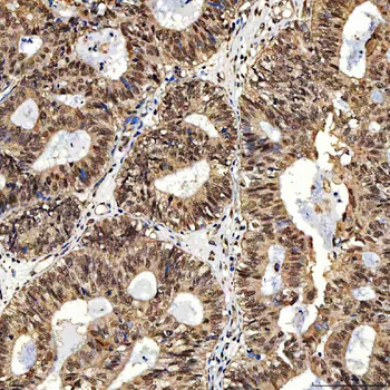 SNF2H/SMARCA5 Rabbit Polyclonal Antibody