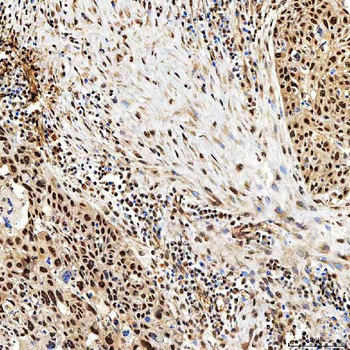 SNF2H/SMARCA5 Rabbit Polyclonal Antibody