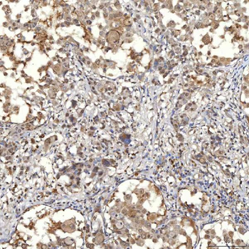 SNF2H/SMARCA5 Rabbit Polyclonal Antibody
