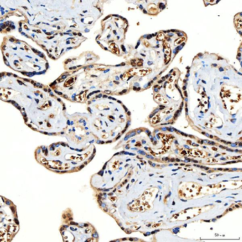 SNF2H/SMARCA5 Rabbit Polyclonal Antibody