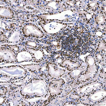SMARCA2/BRM Rabbit Polyclonal Antibody