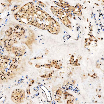 SMARCA2/BRM Rabbit Polyclonal Antibody