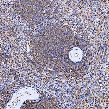 SMARCA2/BRM Rabbit Polyclonal Antibody