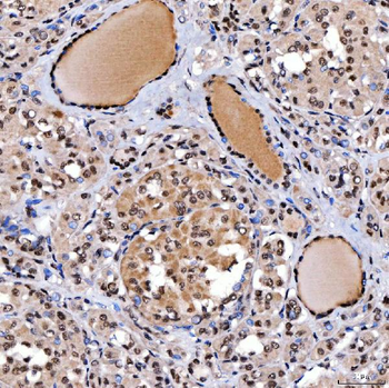 SMARCA2/BRM Rabbit Polyclonal Antibody