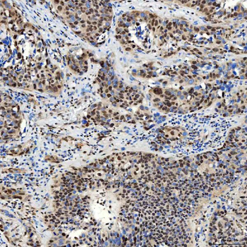 SMARCA2/BRM Rabbit Polyclonal Antibody