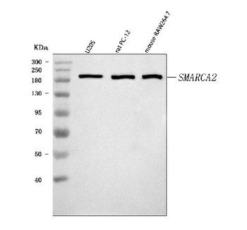 SMARCA2/BRM Rabbit Polyclonal Antibody