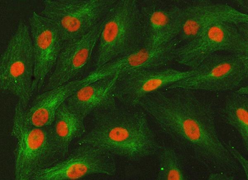 SMARCA2/BRM Rabbit Polyclonal Antibody