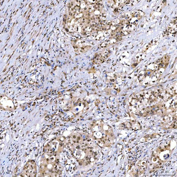 SMARCA2/BRM Rabbit Polyclonal Antibody