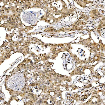 SMARCA2/BRM Rabbit Polyclonal Antibody