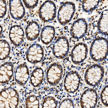 SMARCA2/BRM Rabbit Polyclonal Antibody
