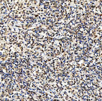 SMARCA2/BRM Rabbit Polyclonal Antibody