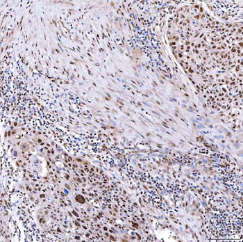 SMARCA2/BRM Rabbit Polyclonal Antibody