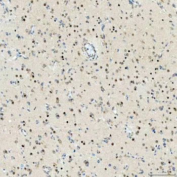 SMARCA2/BRM Rabbit Polyclonal Antibody