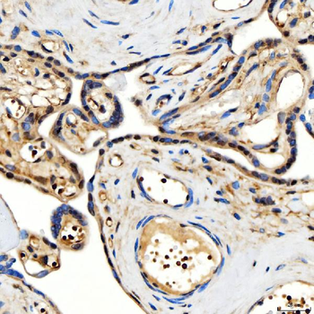 SMARCA2/BRM Rabbit Polyclonal Antibody