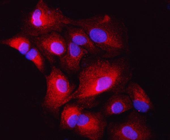 ZIP7/SLC39A7 Rabbit Polyclonal Antibody