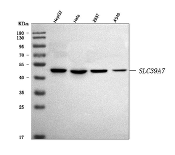 ZIP7/SLC39A7 Rabbit Polyclonal Antibody
