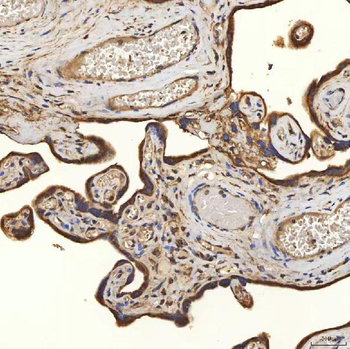 SLC25A24 Rabbit Polyclonal Antibody
