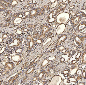 SLC25A24 Rabbit Polyclonal Antibody