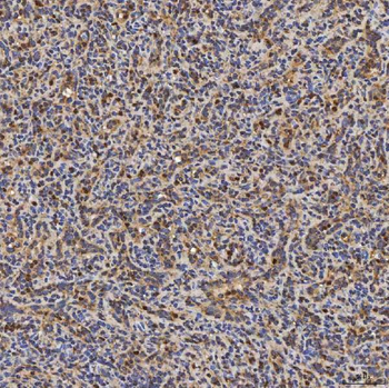 SLC25A24 Rabbit Polyclonal Antibody