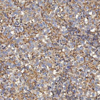 SLC25A24 Rabbit Polyclonal Antibody