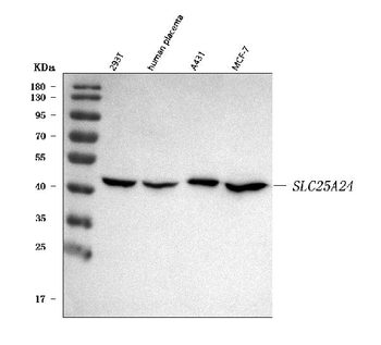 SLC25A24 Rabbit Polyclonal Antibody