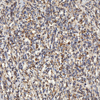 SLC25A24 Rabbit Polyclonal Antibody