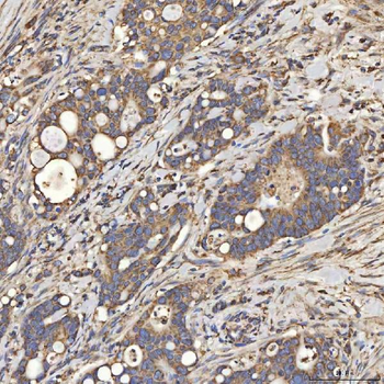 SLC25A24 Rabbit Polyclonal Antibody