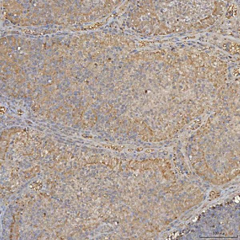 SLC25A24 Rabbit Polyclonal Antibody