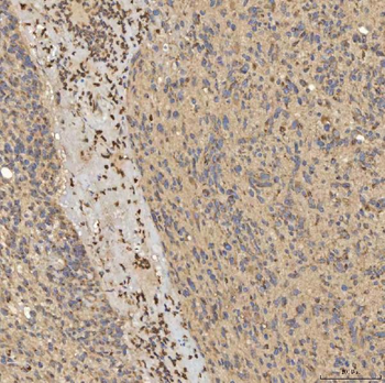 SLC25A24 Rabbit Polyclonal Antibody