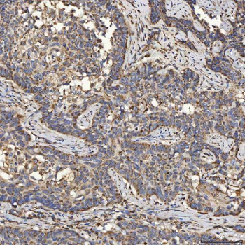 SLC25A24 Rabbit Polyclonal Antibody
