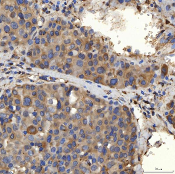 SLC25A24 Rabbit Polyclonal Antibody