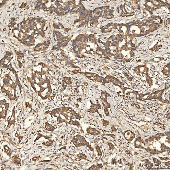 SLC25A24 Rabbit Polyclonal Antibody