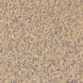 Citrin/SLC25A13 Rabbit Polyclonal Antibody