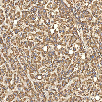Citrin/SLC25A13 Rabbit Polyclonal Antibody