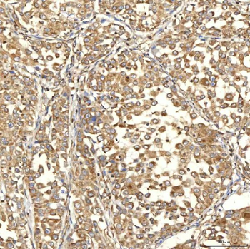 Citrin/SLC25A13 Rabbit Polyclonal Antibody