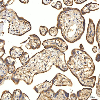 Citrin/SLC25A13 Rabbit Polyclonal Antibody