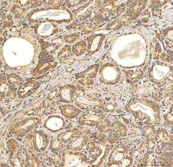 Citrin/SLC25A13 Rabbit Polyclonal Antibody