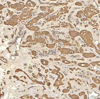 Citrin/SLC25A13 Rabbit Polyclonal Antibody